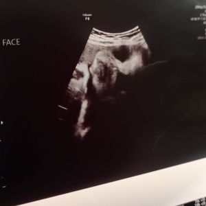 Meet your Posher, Bertha